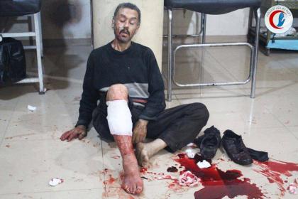 الشبكة السورية لحقوق الإنسان تؤكد مقتل 1771 خلال أكتوبر