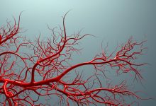 صورة تقنية تصوير جديدة تظهر الأوعية الدموية بشكل غير مسبوق